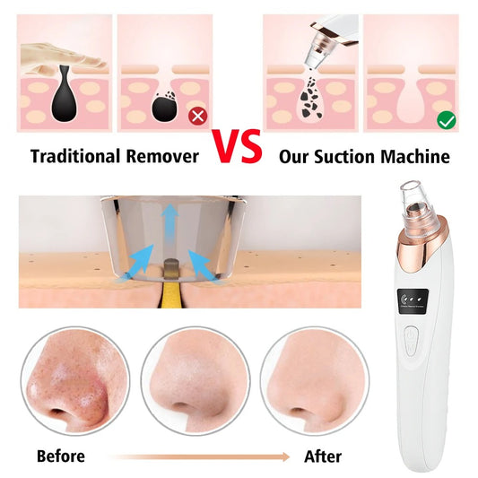 Pore Cleaning Device